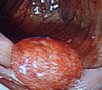 �t���[��