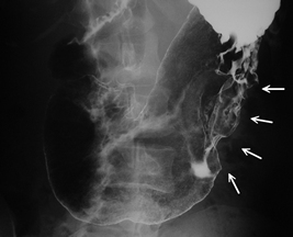 �t���[��